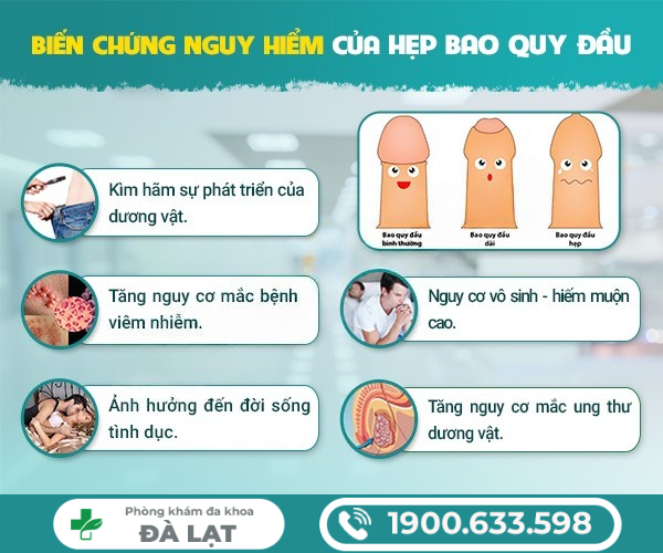 Hình ảnh minh họa